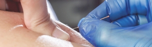 Dry Needling &ndash; &Xi;&eta;&rho;ό&sigmaf; &Beta;&epsilon;&lambda;&omicron;&nu;&iota;&sigma;&mu;ό&sigmaf;